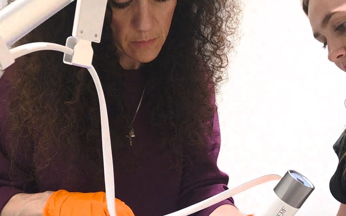 XERF radiofrequency skin tightening treatment at Tri-Health Vaughan